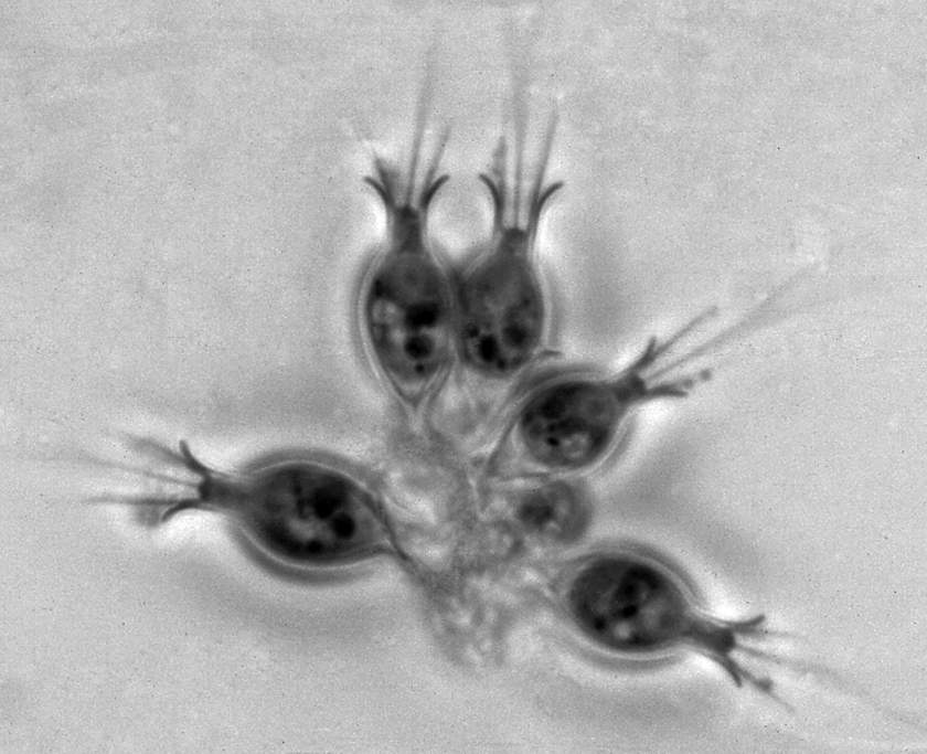 salpingoeca-sp-choanoflagellate-barry-leadbeater.jpg